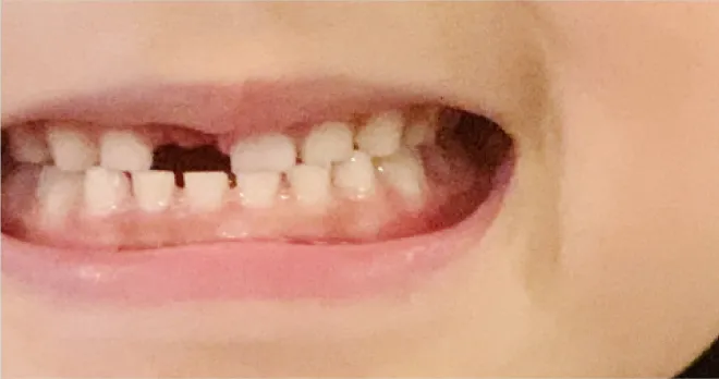 お口の写真をLINEでお送りください(2点)