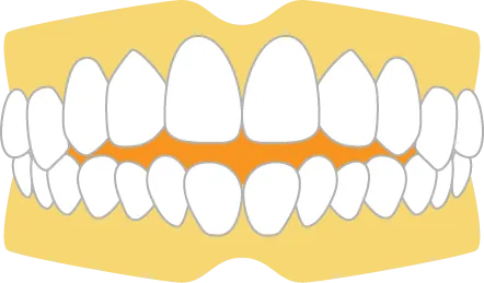 Demerit 1