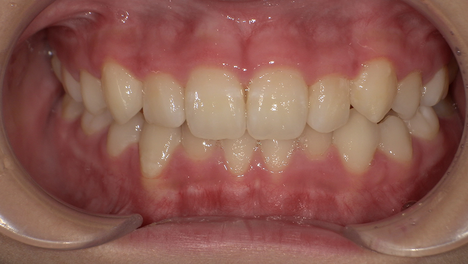 After
