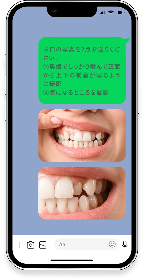 STEP② お悩み内容と歯並びの写真を送る例:マウスピース矯正で対応できますか?/治療期間はどのくらいになりますか?
