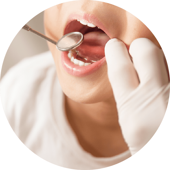 悪い歯並びの予防