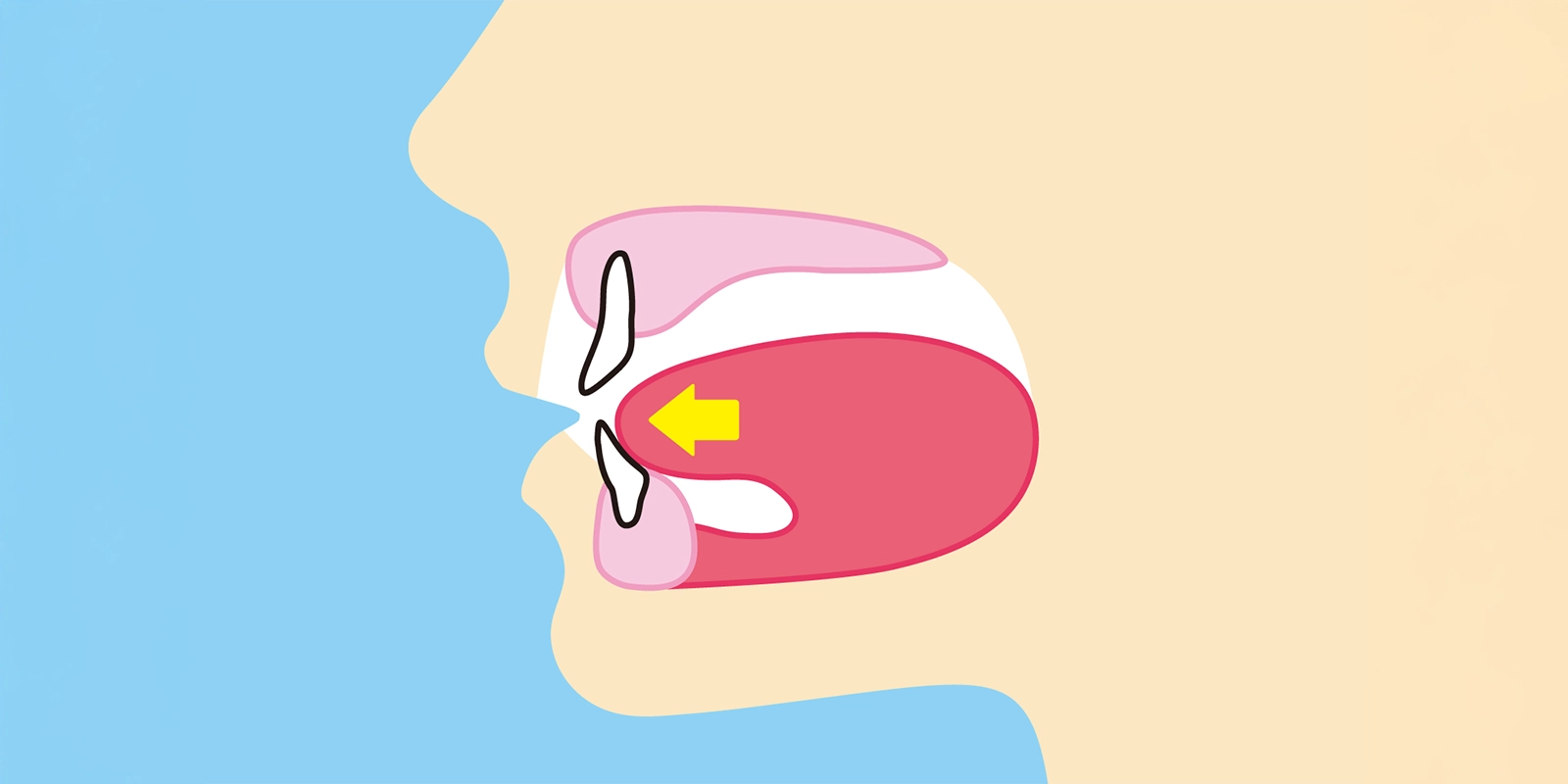 MFTが必要なケース