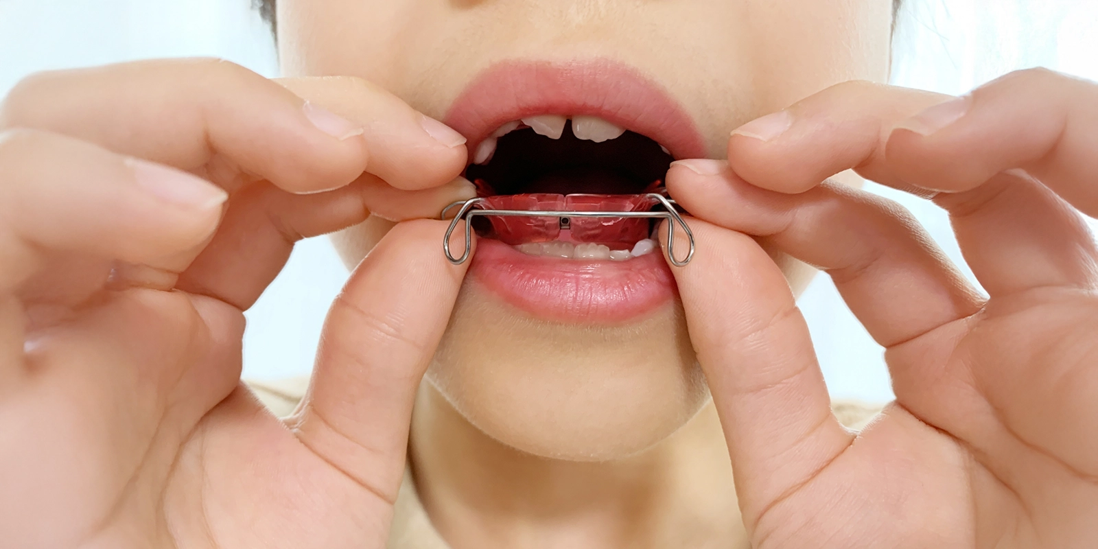 MFTを行うメリット