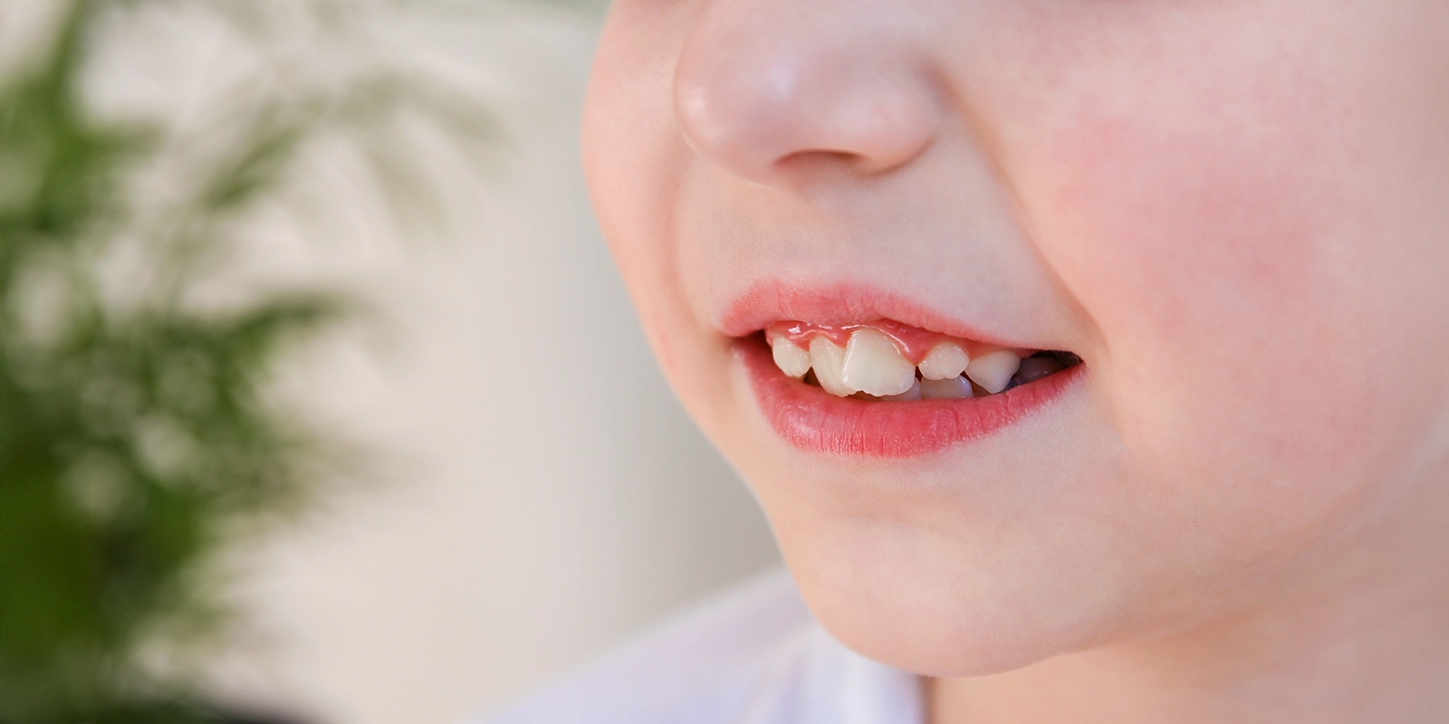 MFTをせず舌癖を放置するとどうなる?