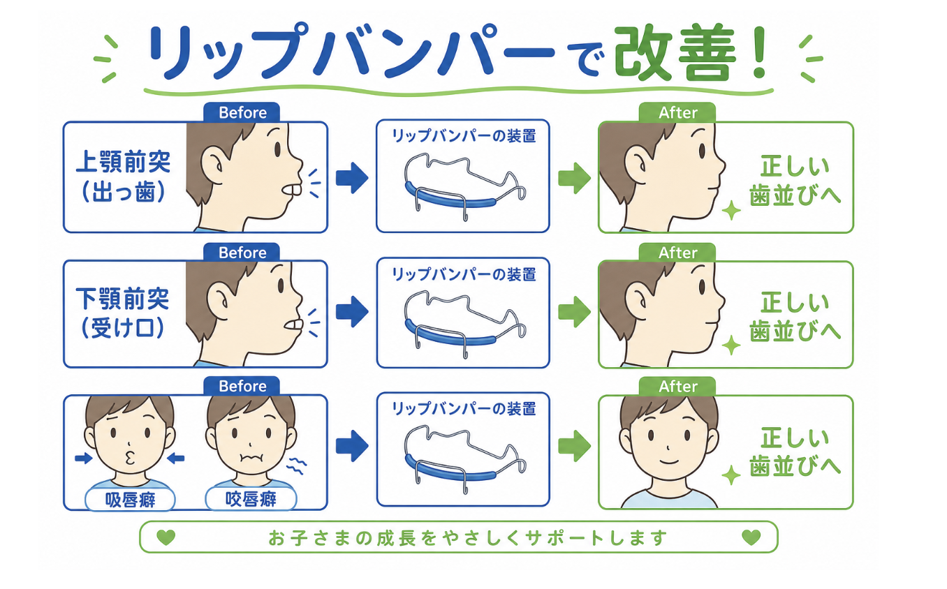 リップバンパーで改善が期待されること