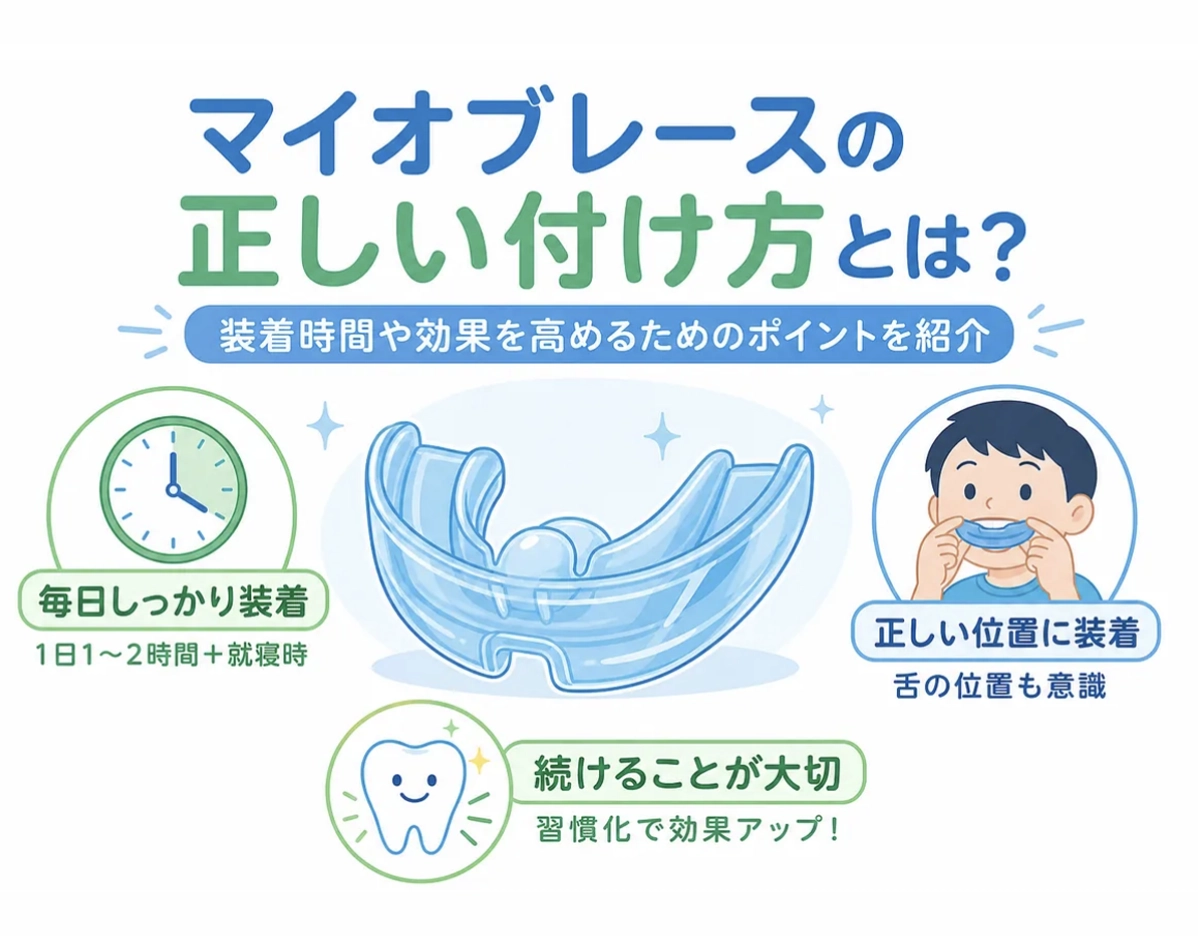 マイオブレースの正しい付け方