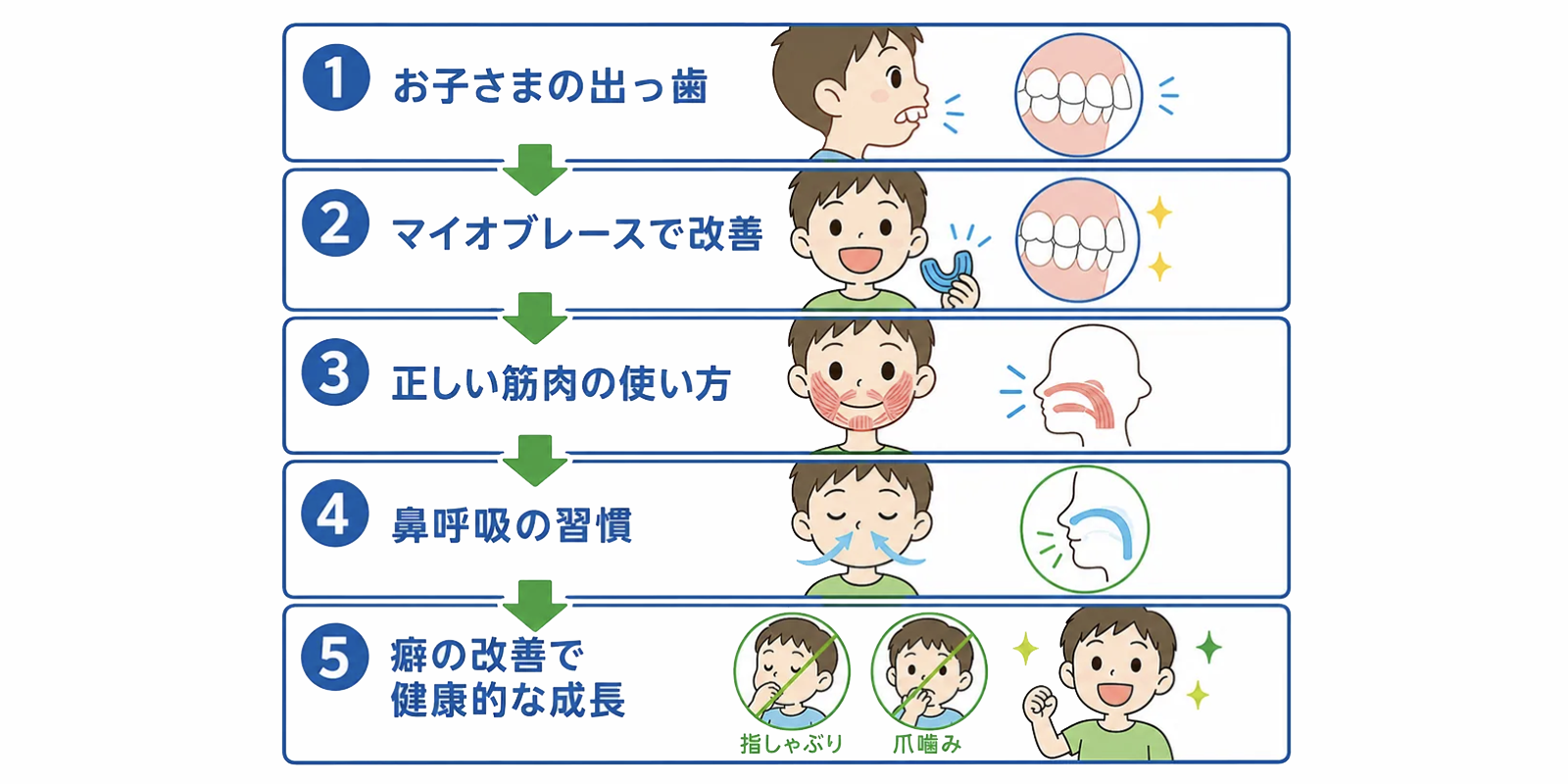 マイオブレースで出っ歯は改善できる?